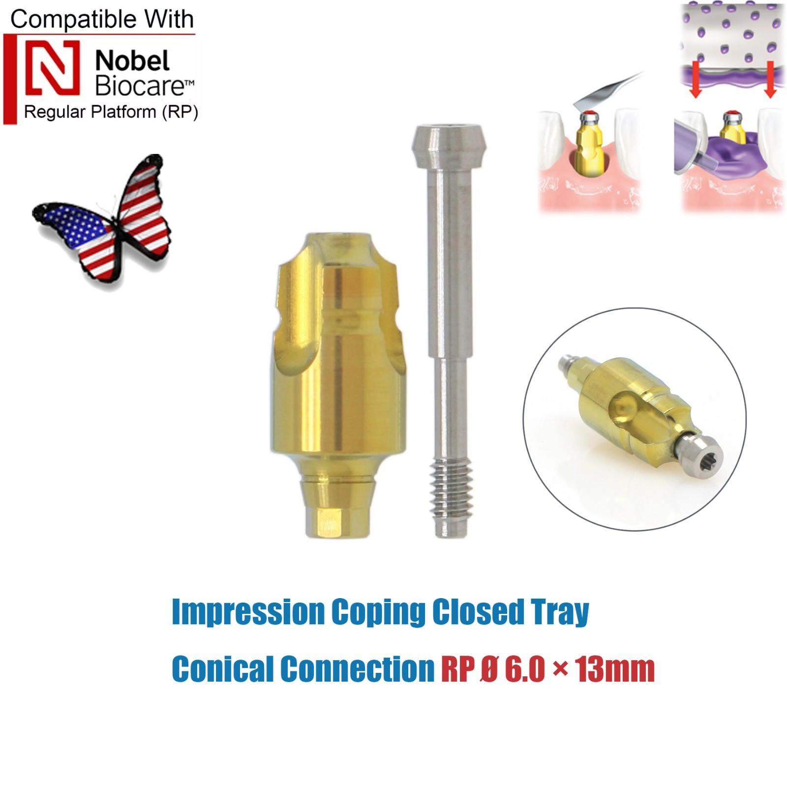 Dentaltech Closed/Open Tray Impression Copings Nobel Biocare Implant Compatible