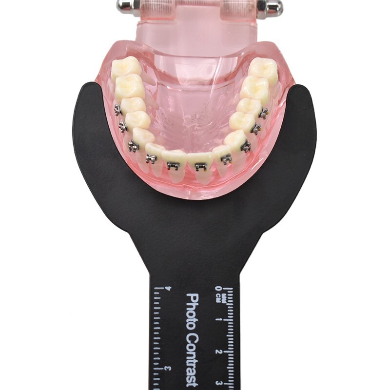 1Set Dental Photo Contrast Black Background Board Palatal Photography Contraster
