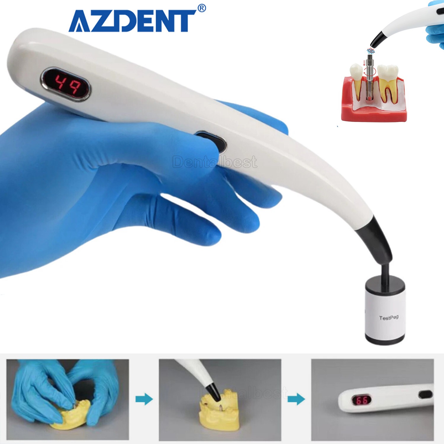 AZDENT Dental implant Osstell Beacon Isq Implant Stability Meter Tool Instrument