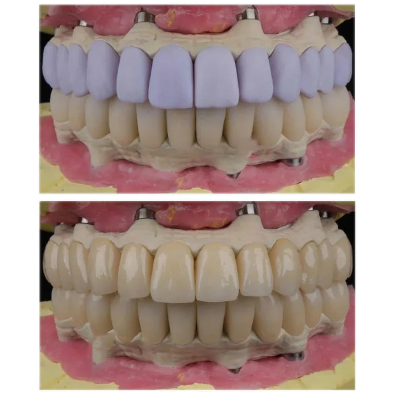 US C14 Dental Lithium Dislicate Block For Sirona Cerec IPS e.max CAD CEREC Block