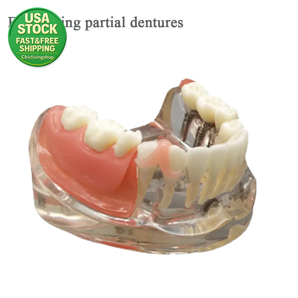 DIY Denture Gum Material Tooth Repair Kit 30G Flexible Reusable Fitting