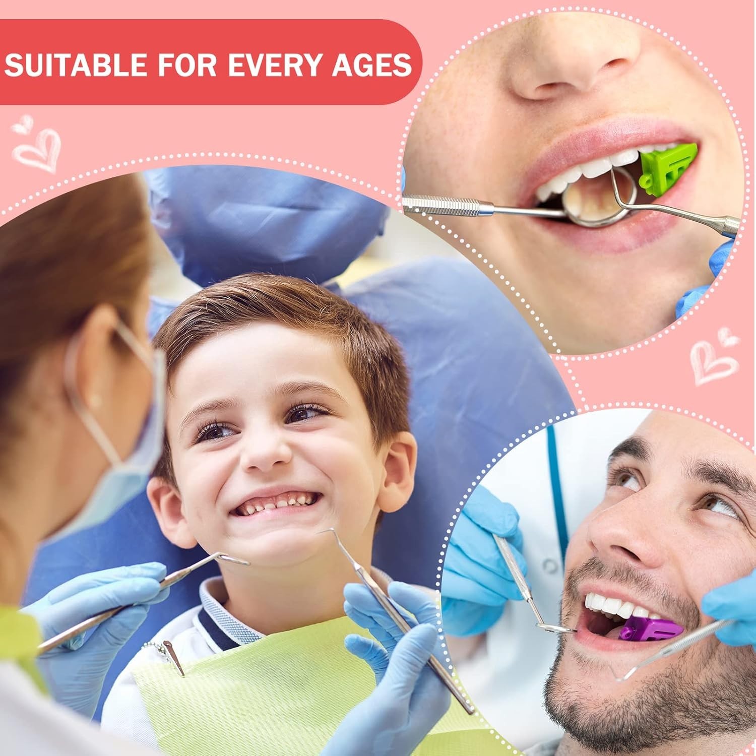 12 Pcs Color-Coded Dental Mouth Props – Silicone Blocks for Easy Size Selection
