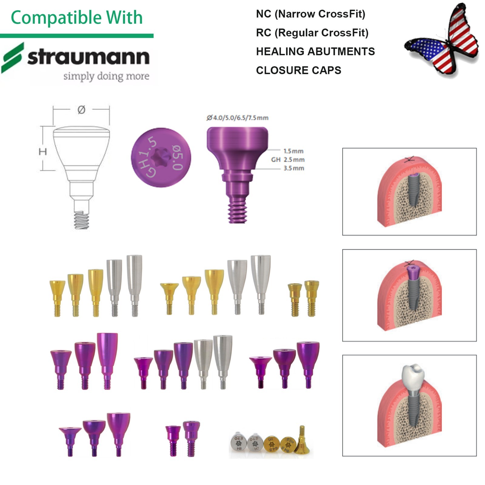 Fit Straumann ITI Healing & Locator Abutment Impression Transfer Analog Scanbody