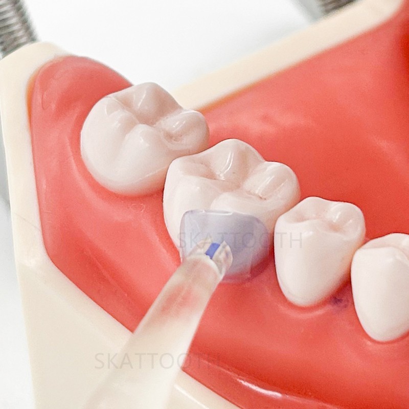 Dental Transparent Cervical Matrices Composite Gingival Retractor Clear Matrix