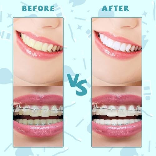 100PCS Interdental Brushes Between Teeth for Braces, Flossers Brush Cleaner, Ort