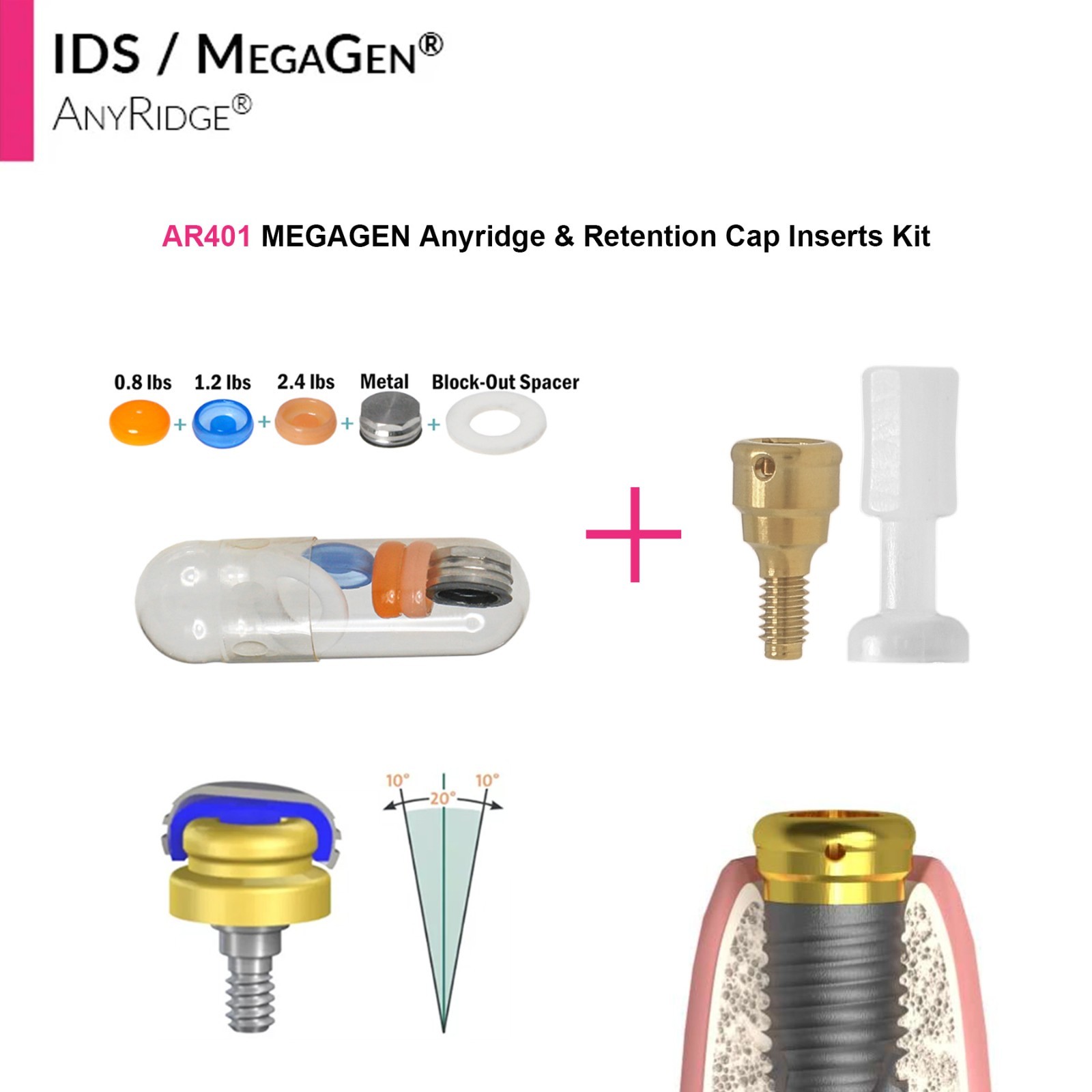 Dental Overdenture Locator Abutment Anchor for MEGAGEN AnyRidge 4.0 Platform Cap