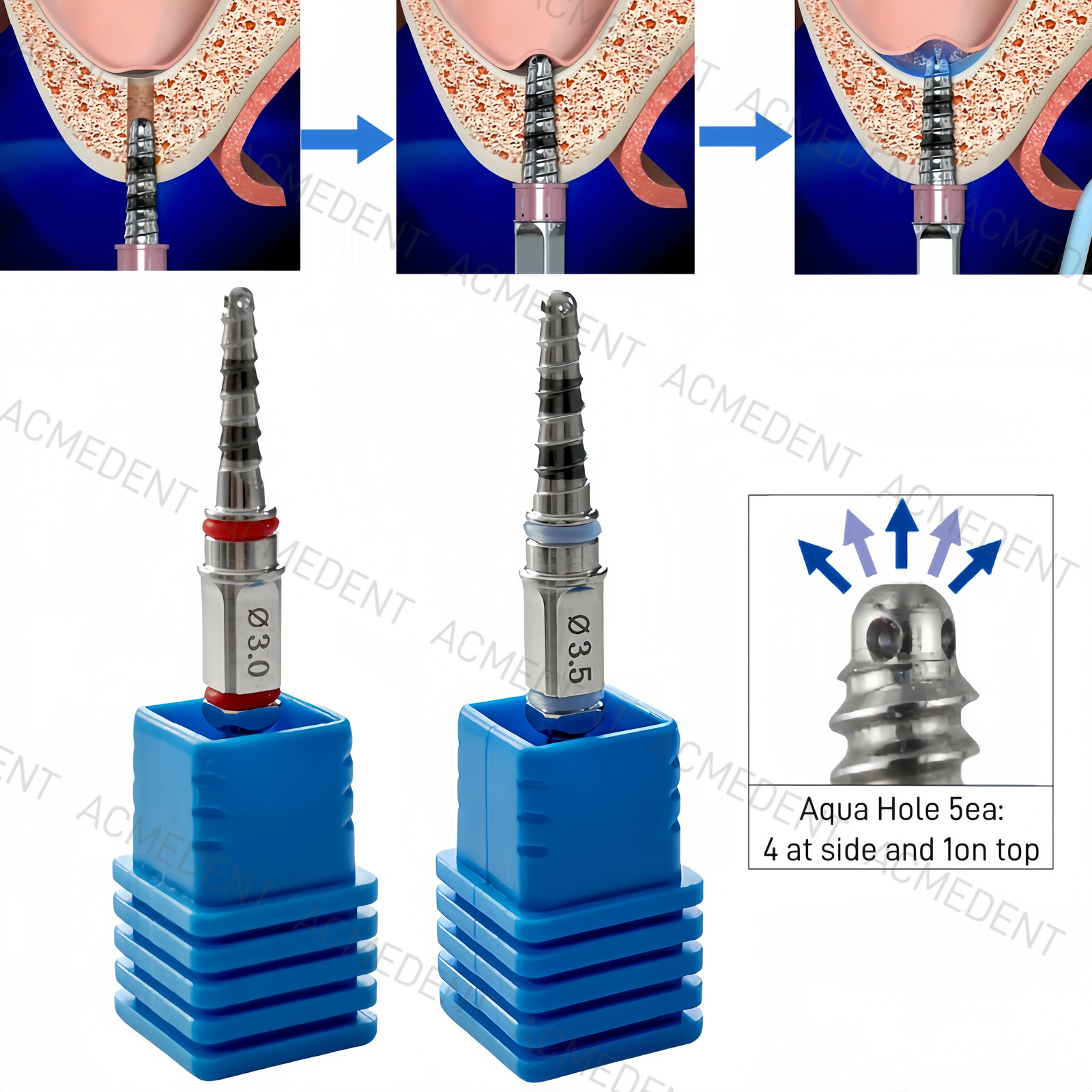 Dental Maxillary Sinus Lift Membrane Water Rising Hydraulic Lifter Aqua Tip Wate