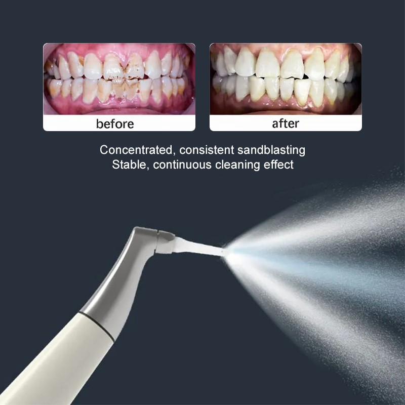 Dental Air Polisher Supragingival/Subgingival 2 in 1 Teeth Whitening Sandblaster