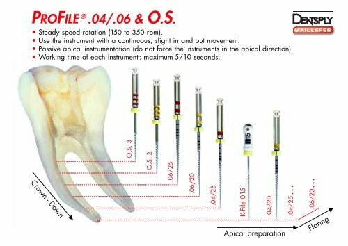 Dentsply Maillefer Dental Profile ISO 21mm .04 Taper rotary files 6/pk all sizes