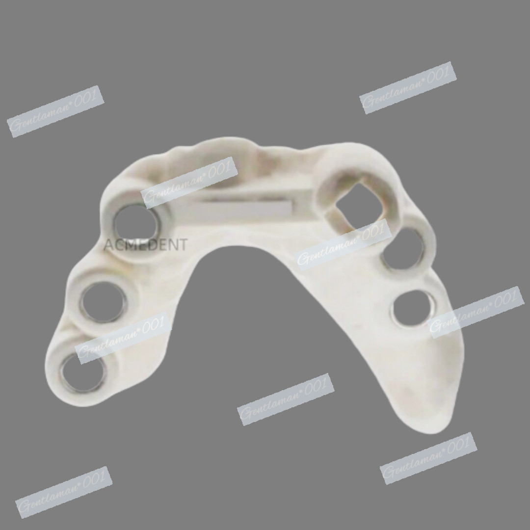 Dental Implant Pilot Anchor Drill Fixing Nail Guide Sleeves Digital Jaw ∅2.0mm