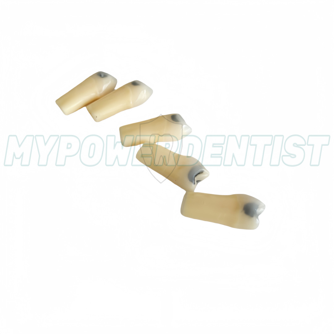 Dental Cavity Teeth Model Tooth Teaching Caries 25# Compatible Frasaco AG-3