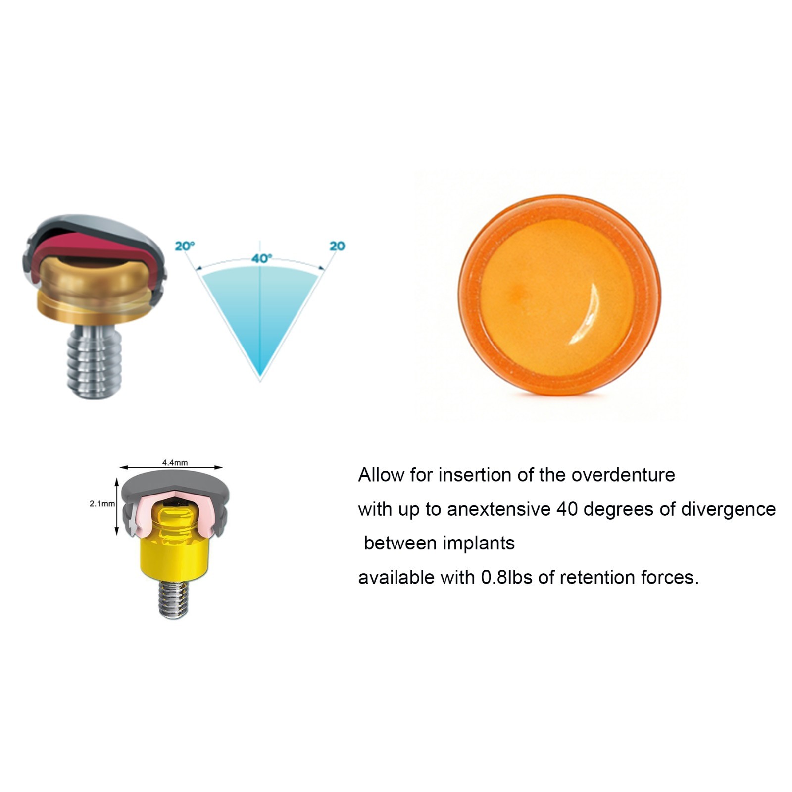 Hiossen ET Mini Regular Legacy Locator Abutment platform Male cap insert Replace