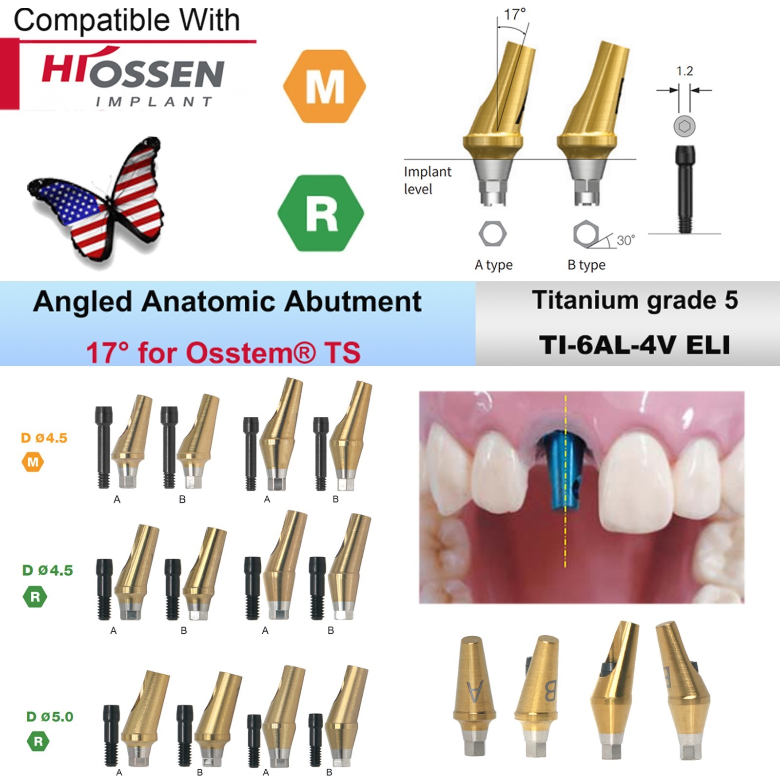 US Fit Hiossen ET / Osstem TS Dental Titanium Abutments & Restorative Components