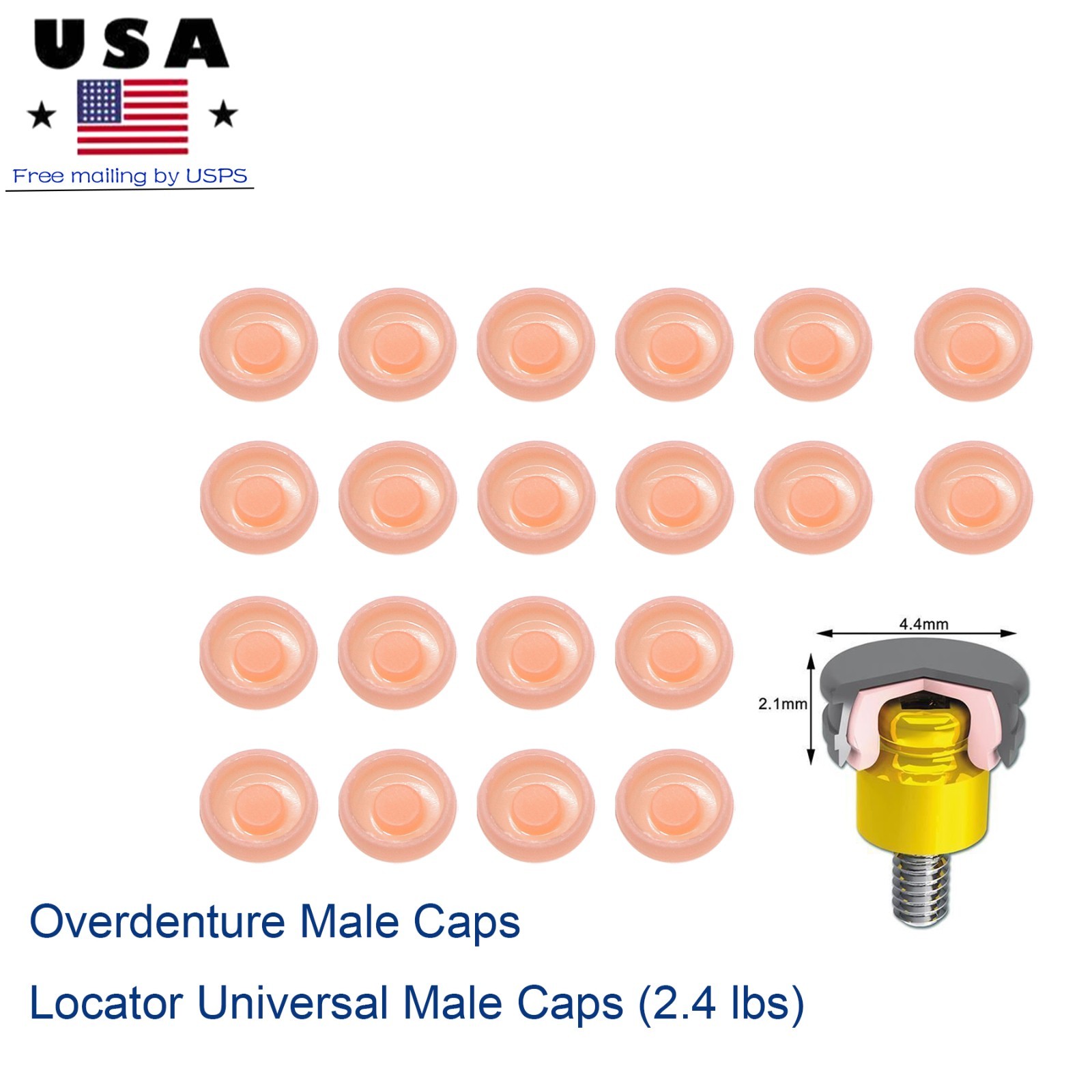 20Pcs Dental Overdenture Locator Abutment Replacement Retention Cap Inserts Set