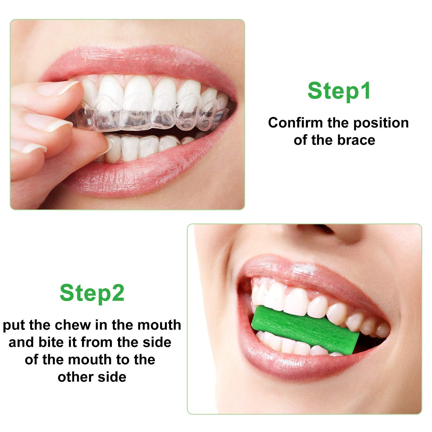 10 Green Aligner Trays Seater – 10 Pack Orthodontic Dental Aligners