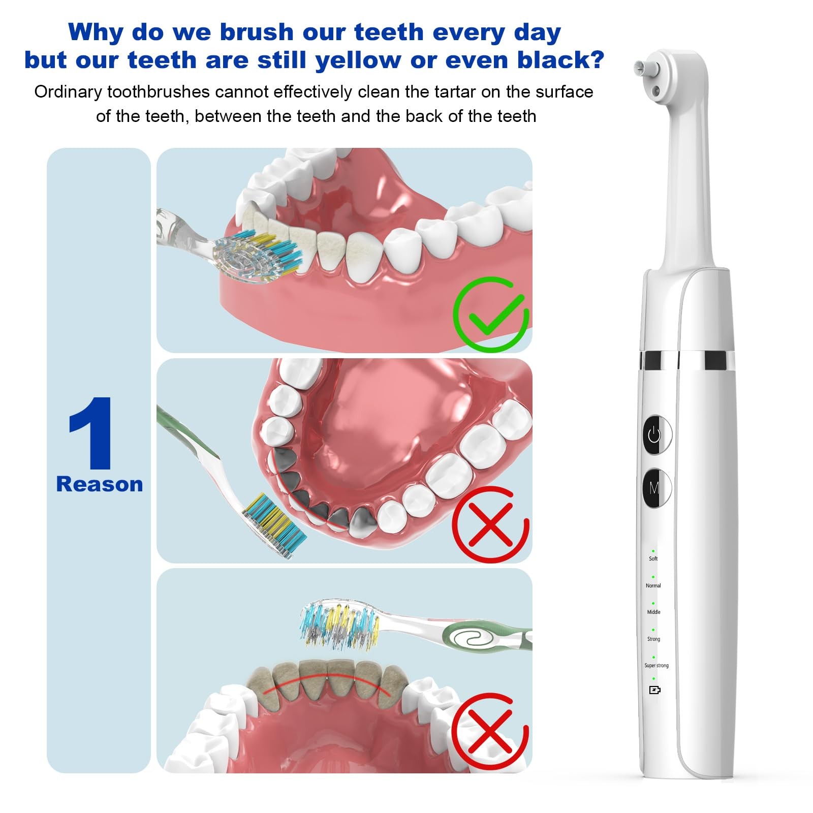 Tooth Polisher,Teeth Polishing Kit for Daily Cleaning,Polishing Then Whitening O