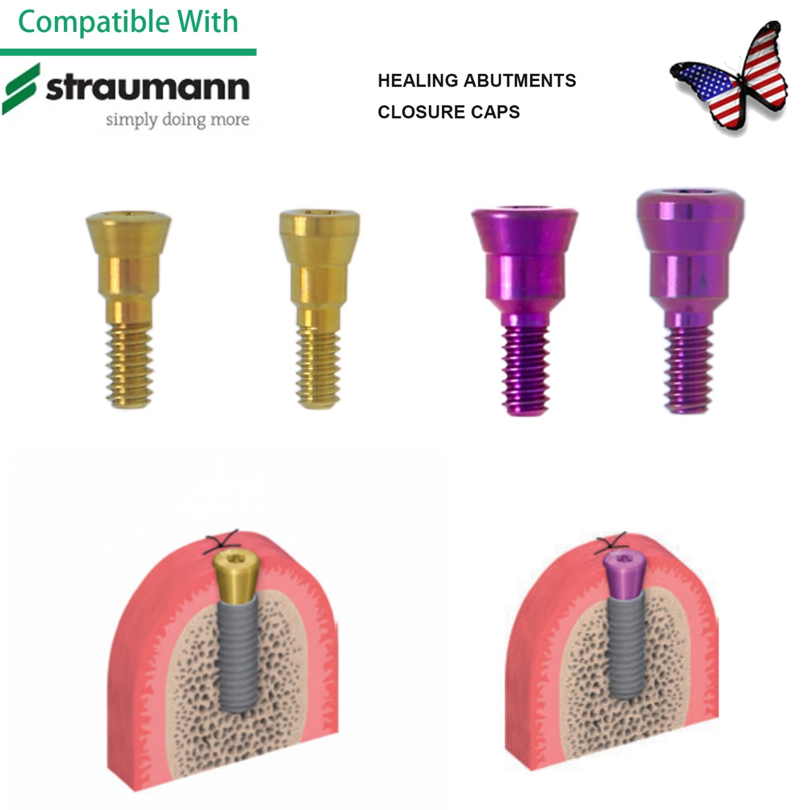 US Healing Abutment Closure Cover Screw Cap N/RC fit Straumann Bone Level BL BLT