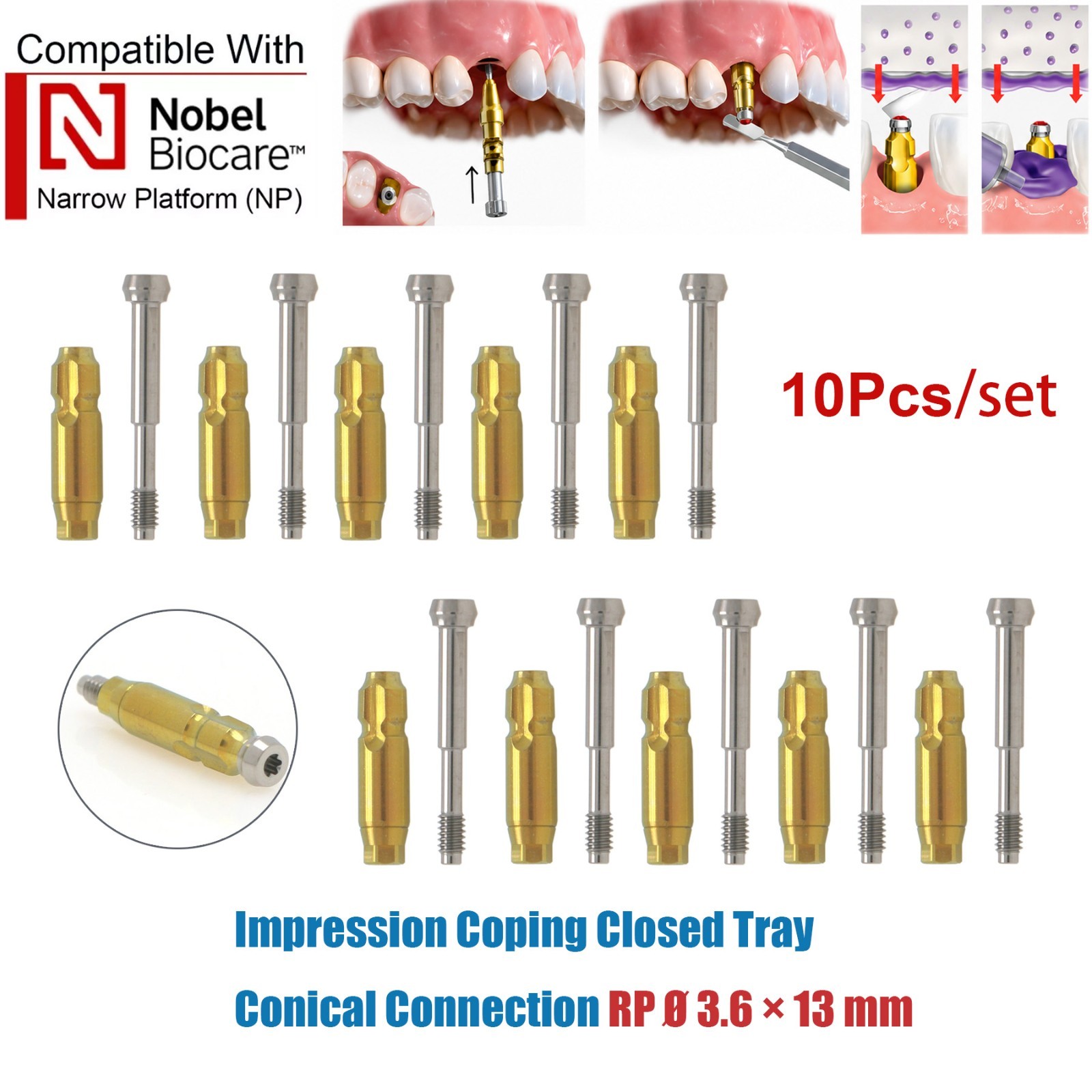 US 10Pcs Impression Transfer Coping Open Closed Tray fits Nobel Active NP RP Hex