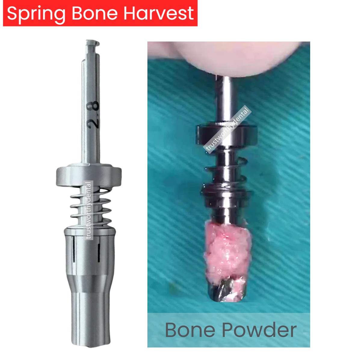 φ2.8 Dental Bon Harvest Spring Drill Trephine Bur Self-grinding Collector