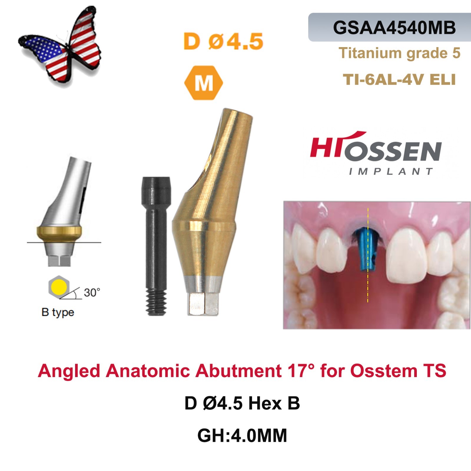US 5Pcs 17° Angled Anatomic Abutment Hiossen Osstem Mini Regular Hex Titanium