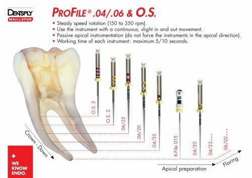 Dentsply Maillefer Dental Profile ISO 21mm-25mm Taper rotary files 6/pk all size