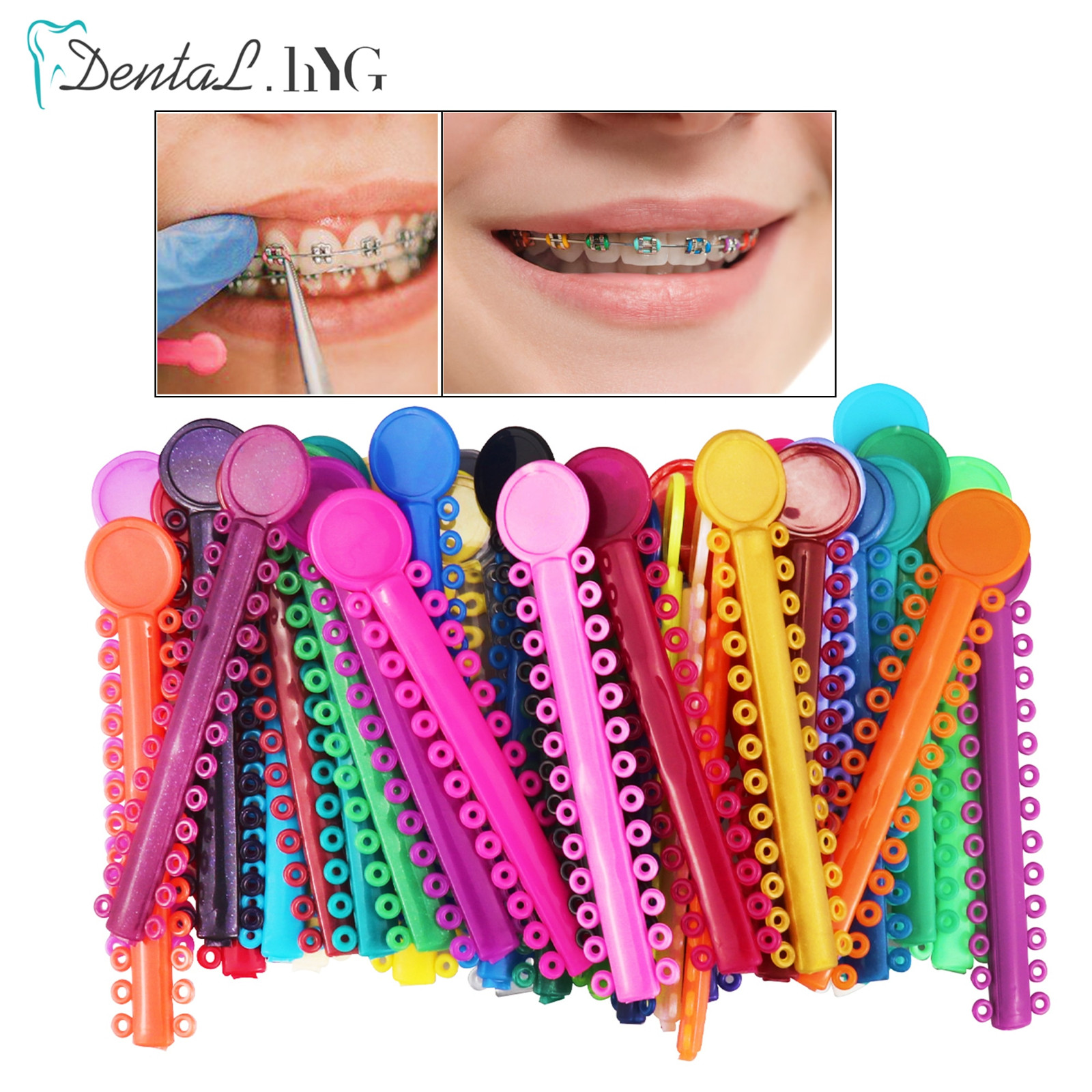 O & S Dental Topsticks High Performance Ortho Elastic Ligature Ties All Colors
