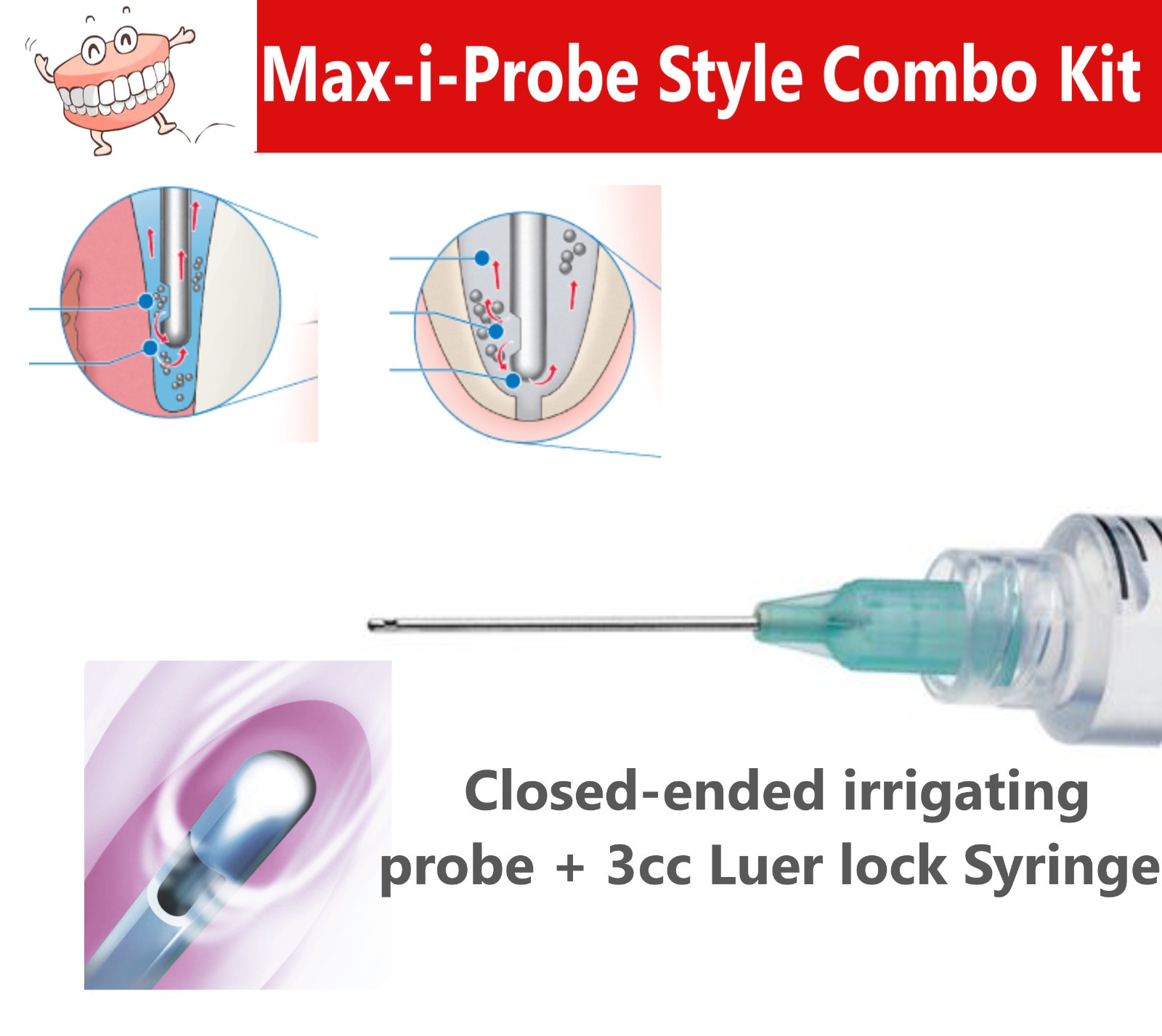Dental Endo Irrigation Kit 3cc, Complete Kit Max-I-Probe Type, All Sizes