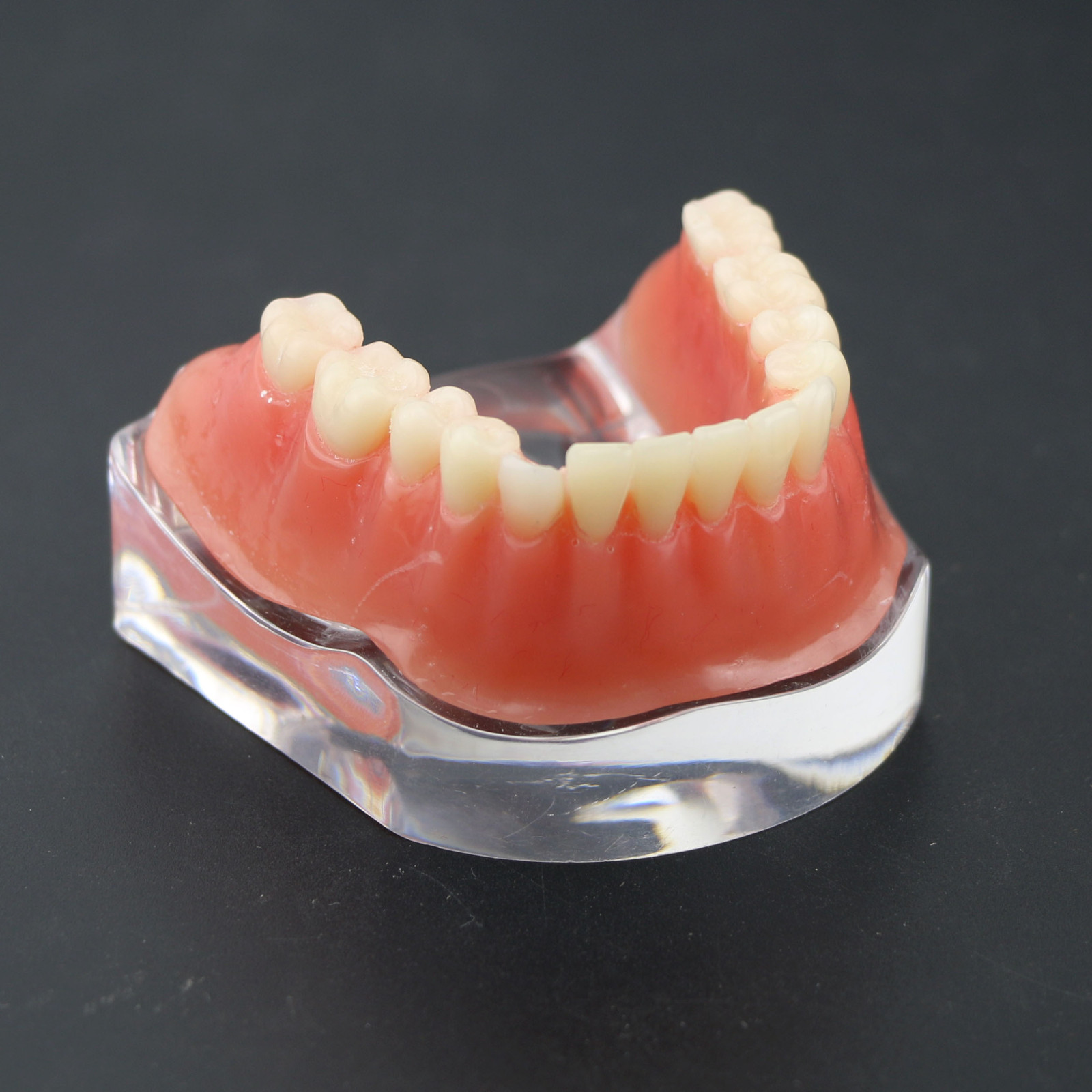 Dental Teeth Implant Model Inferior Overdenture 4 Implants Denture Demo Training