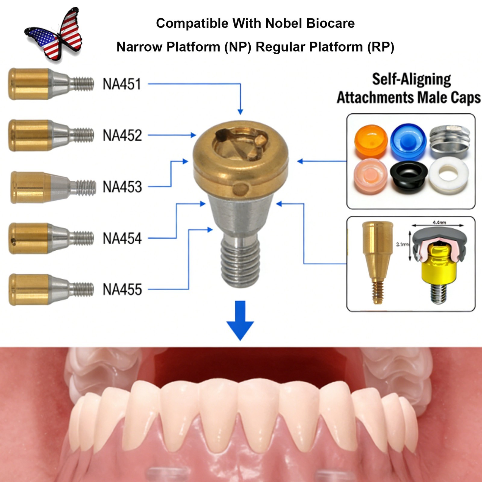 Dental Nobel Biocare Active NP/RP Locator Abutment Conical Titanium 1-5mm Height