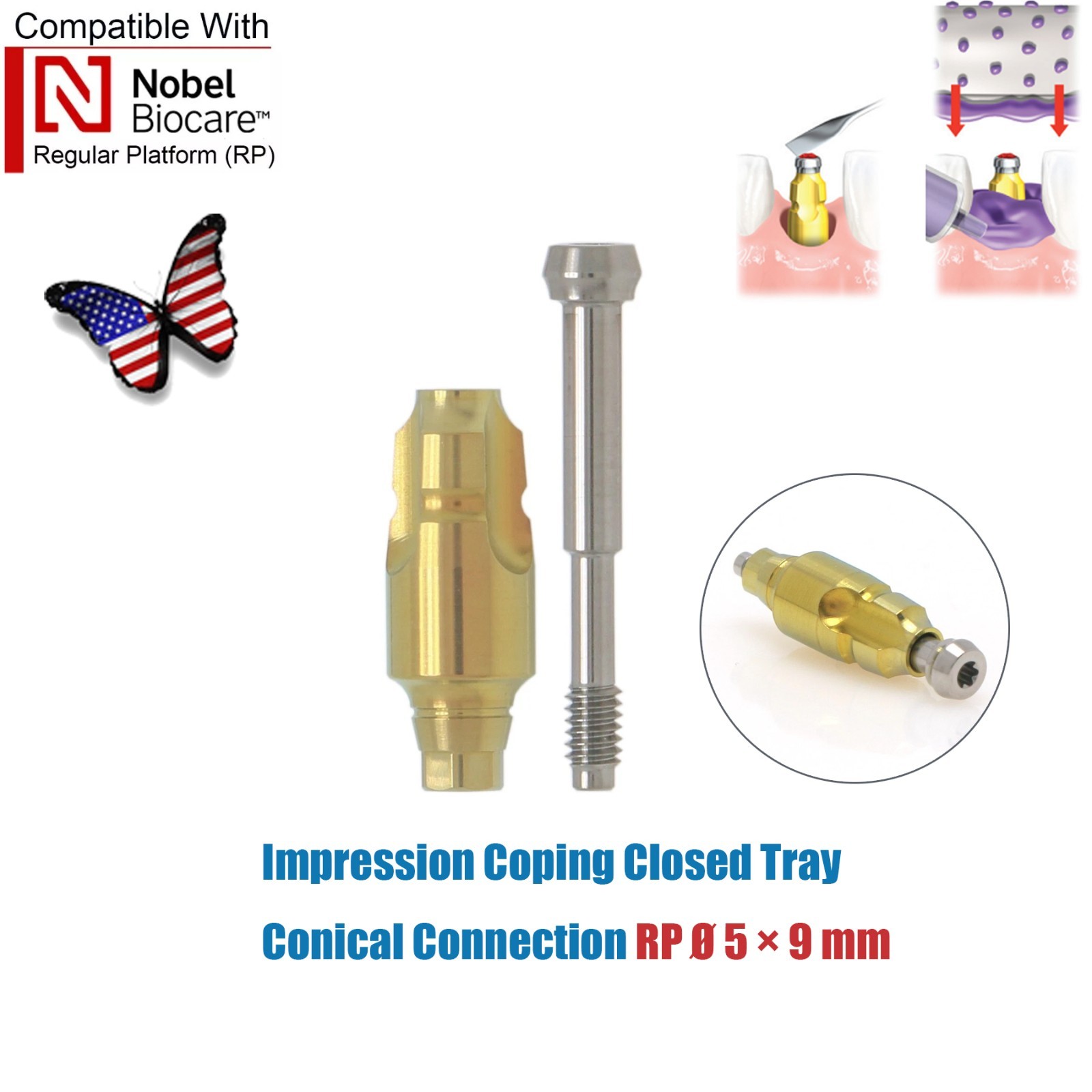 Dentaltech Closed/Open Tray Impression Copings Nobel Biocare Implant Compatible