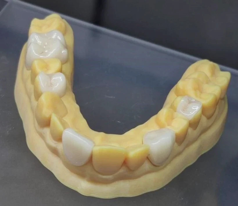 US Stock Dental C14 MT Lithium Disilicate Ceramic Blank For CEREC CAD/CAM