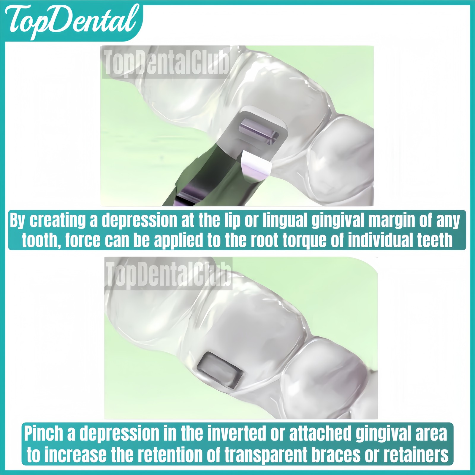 Dental Horizontal Plier Aligner Braces Invisible Retainer Thermal Ortho Plier