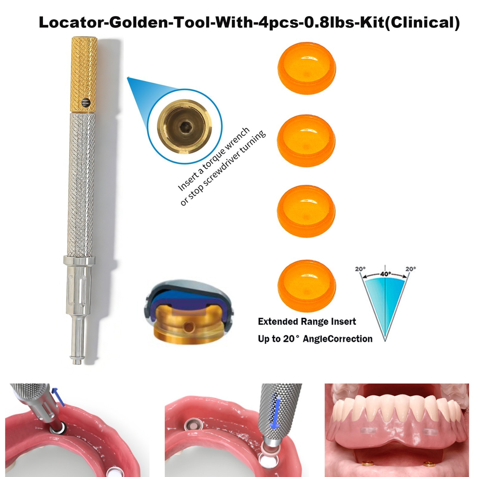 US Universal ZEST Locator PEEK Retention Cap Insertion Lab Core Extraction Tool
