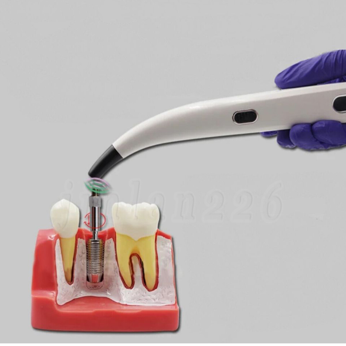 2024 Dental ISQ Implant Stability Device Dental Implant Monitor Osseointegration