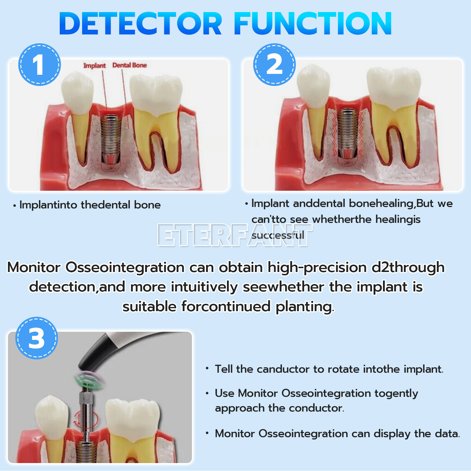 Dental Monitor Osseointegration RFA Inplant Test Unit/20:1 Implant Handpiece