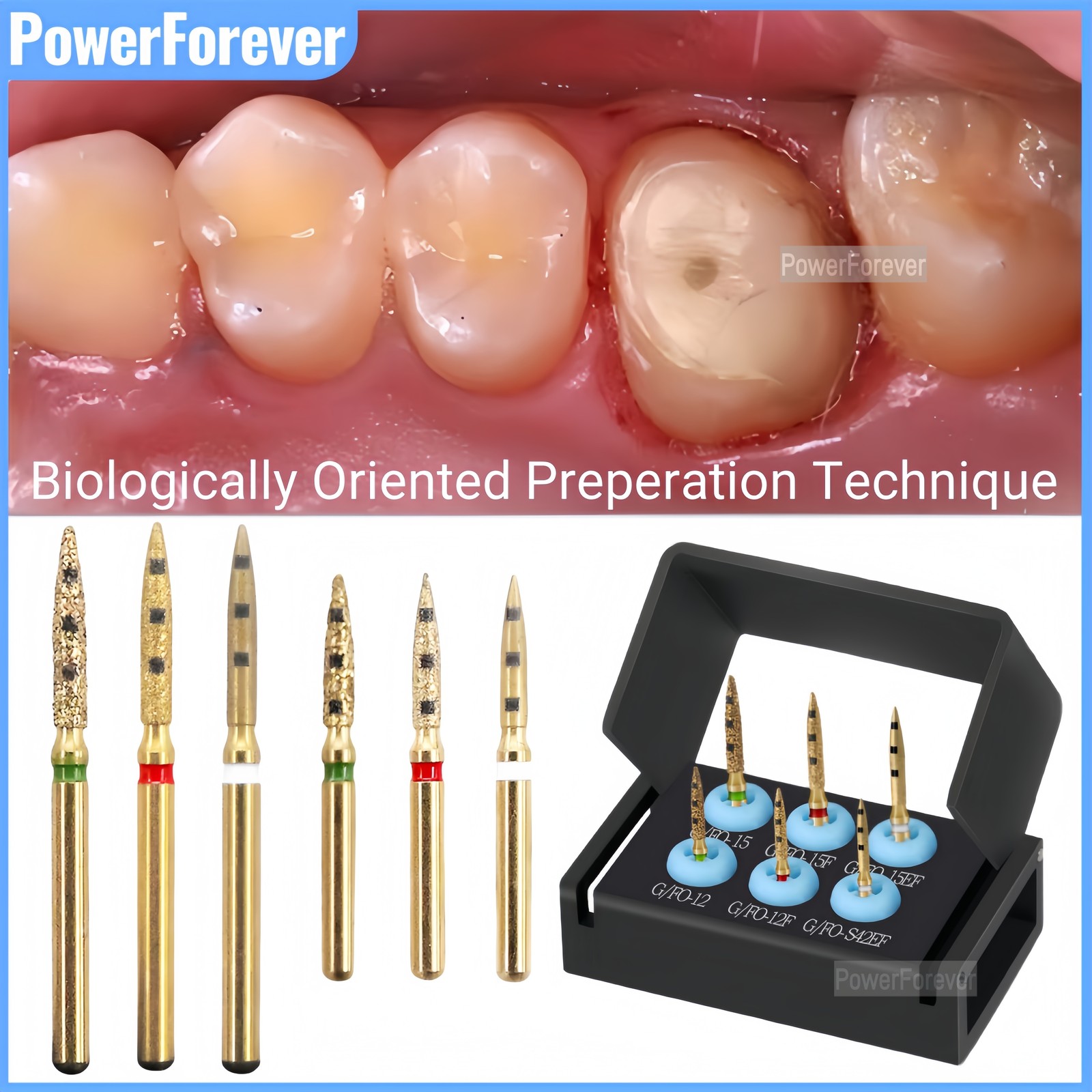 Dental BOPT Bur Vertical Restoration Biologically Oriented Preperation Technique