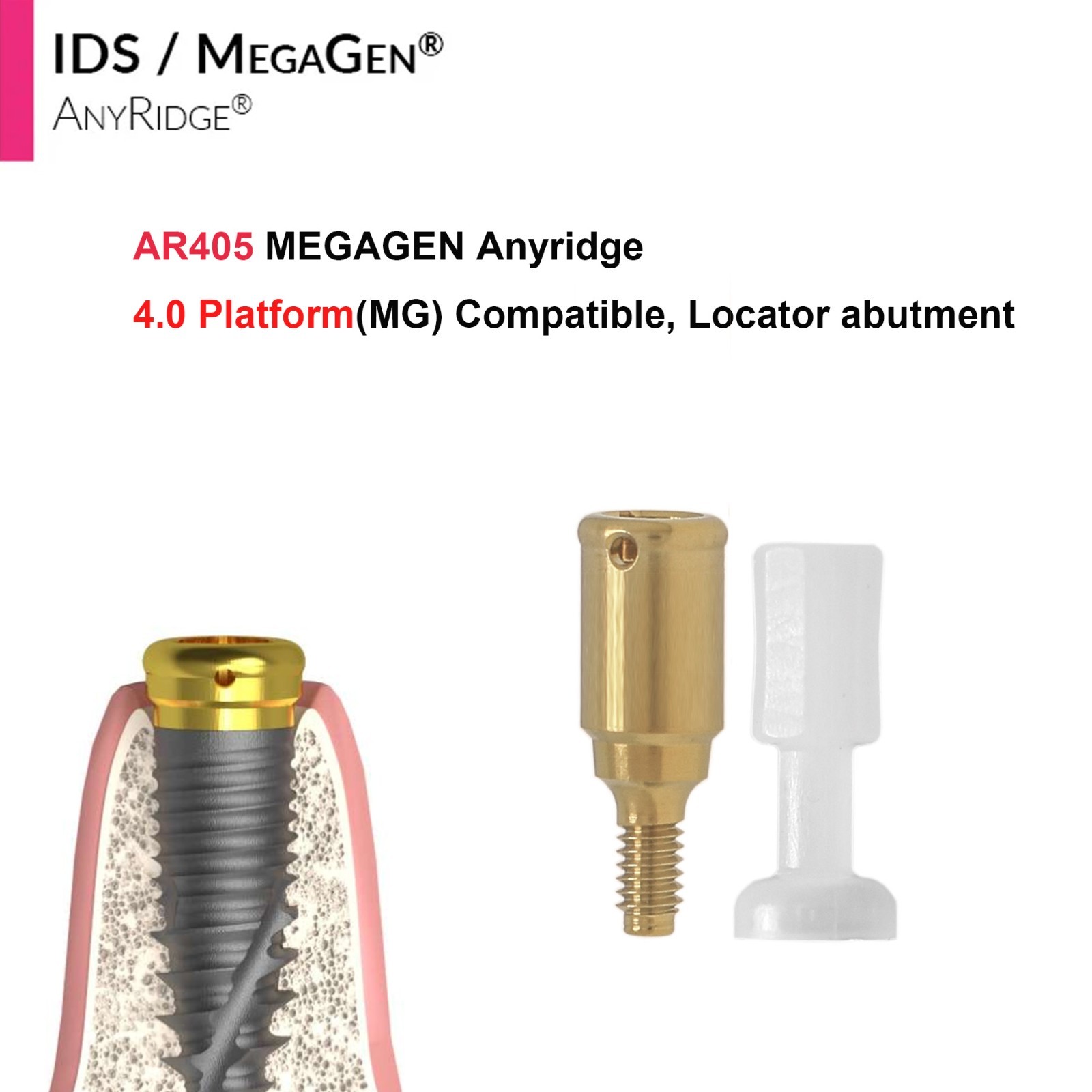 Implant Fit Zest Locator Abutment Hiossen/Nobel/Zimmer/GM/MegaGen /Straumann