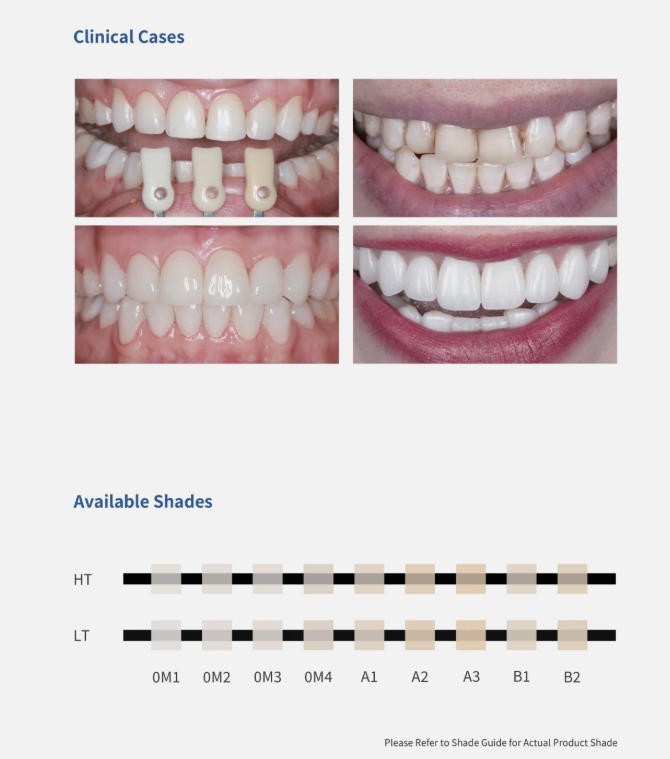 C14 Emax CAD/CAM All-Ceramic Dental Glass Without Sintering Cerec Block 5PCS/BOX