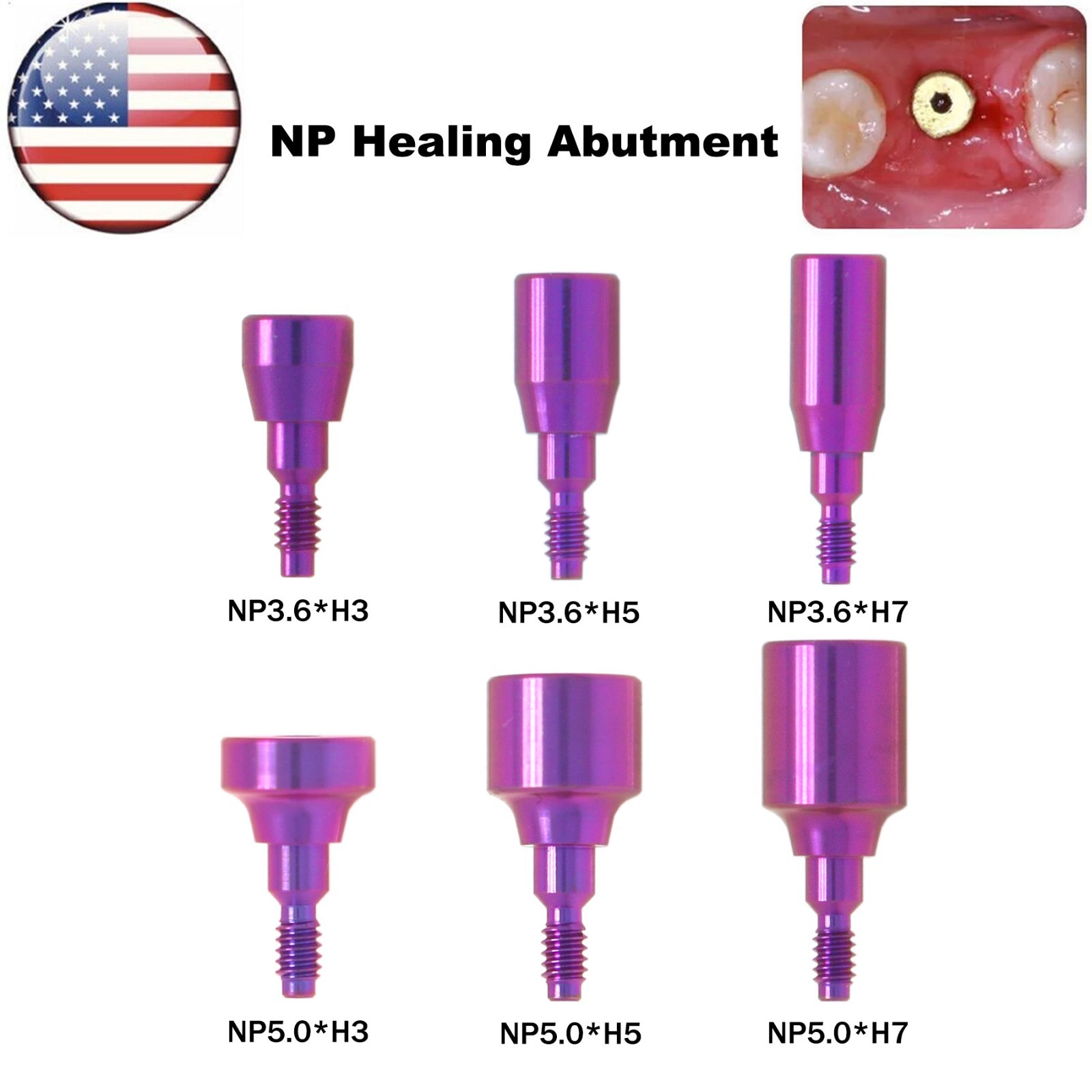 US Dental Nobel Healing Abutment Caps RP/NP Fit NOB Active ∅3.6/5.0/6.0 H3/5/7mm