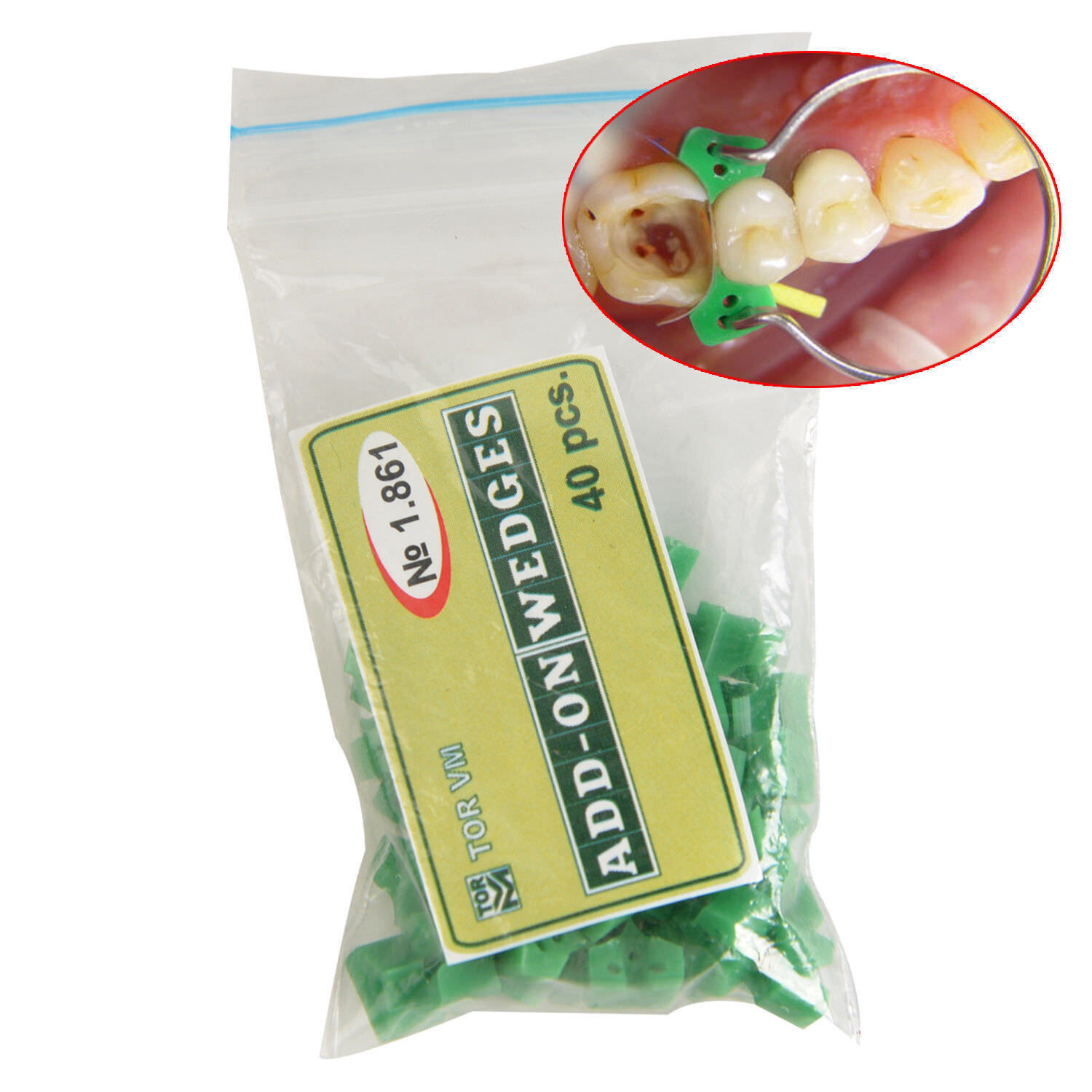 40 Pcs Dental Silicon Orthodontics Autoclavable Silicon Rubber Elastic Matrix