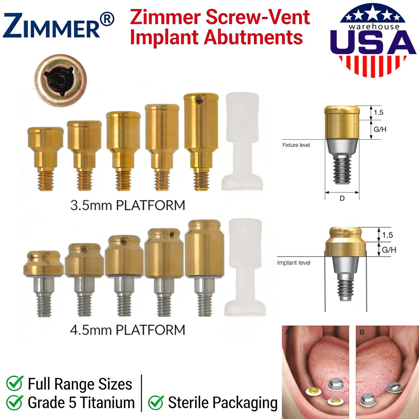 US Dental Locator Abutment Male Caps Kit Fit Hiossen Nobel Zimmer Implant System