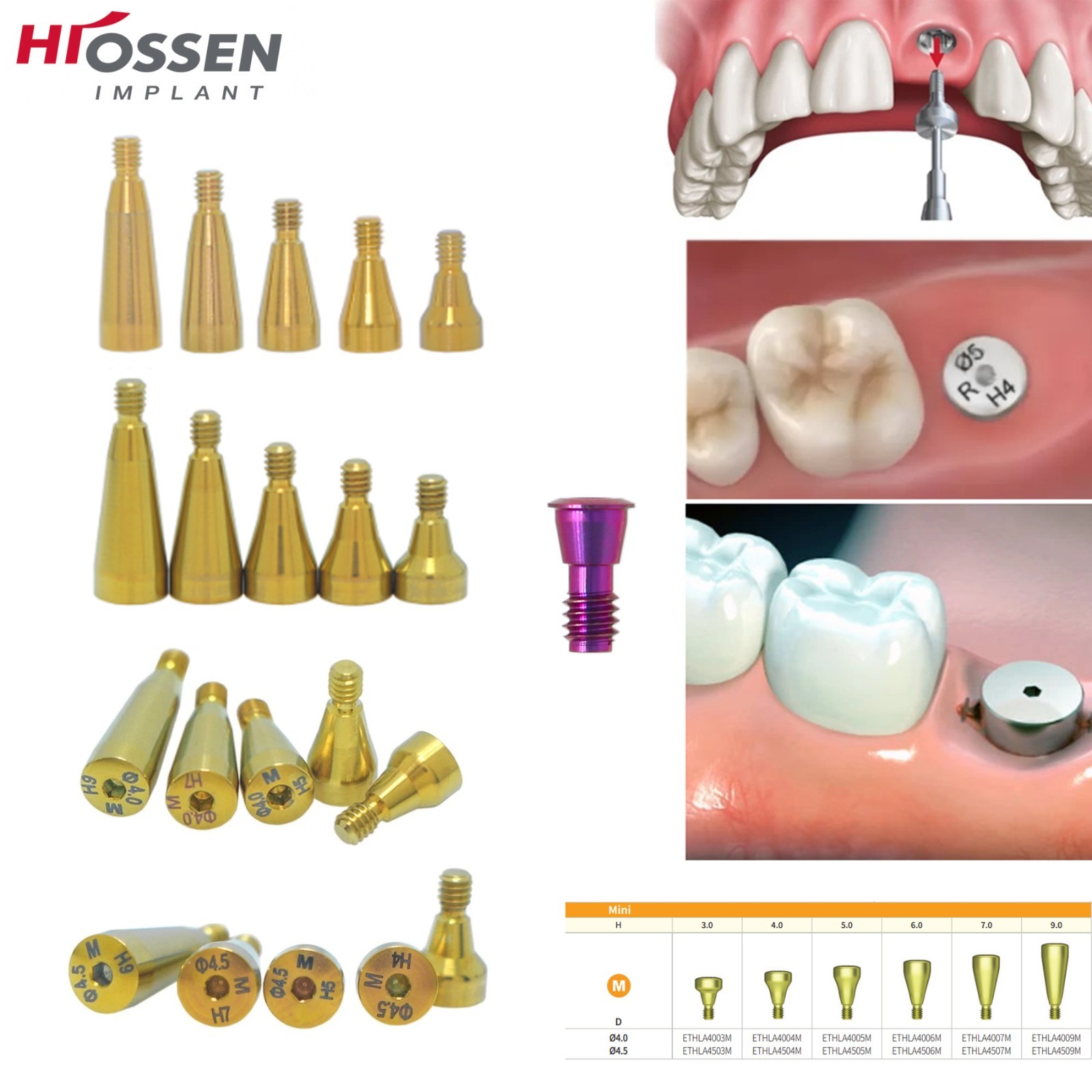 US Dental Titanium Mini Healing Abutment & Cover Screw Fits Hiossen ET Osstem TS