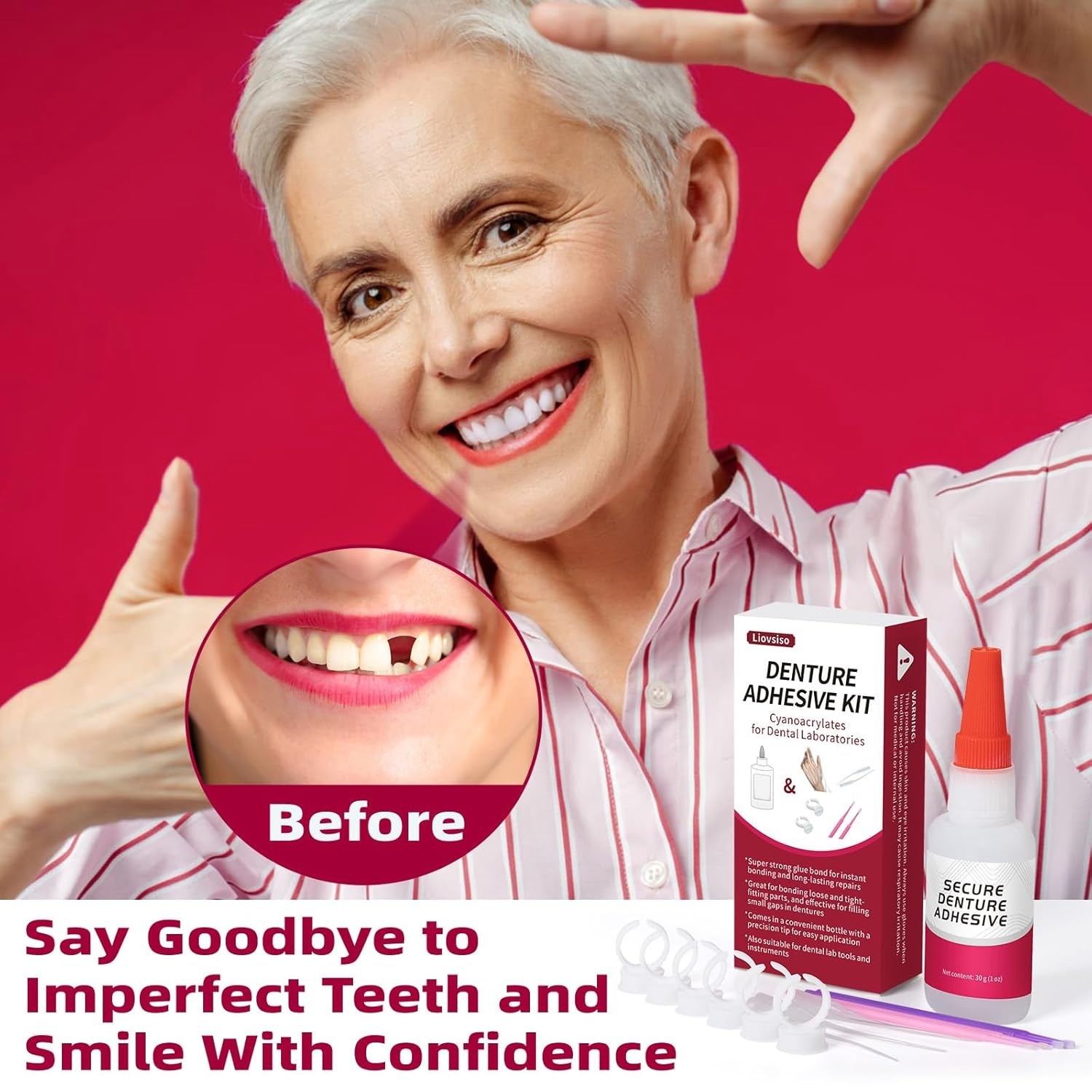 1oz Dental Lab Glue for Quick Denture Repairs – Secure Bonding in Seconds