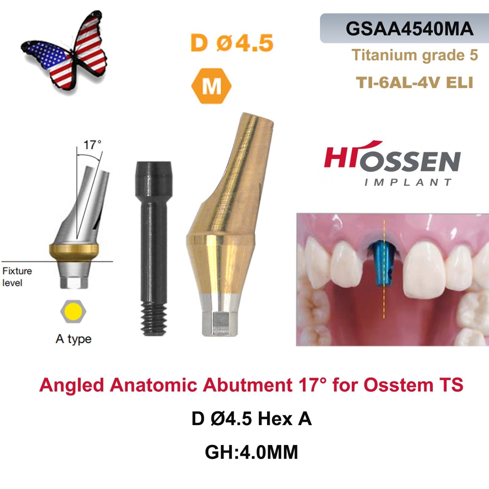 US 17° Dental Angled Anatomic Abutment Hex Compatible with Hiossen ET/Osstem TS