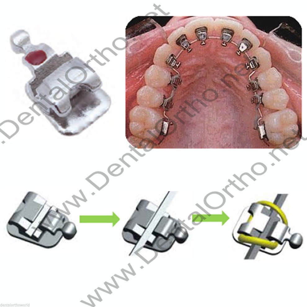 28Pcs/kit, 1D lingual brace w/h3 dental orthodontic buccal tube archwire 7-7