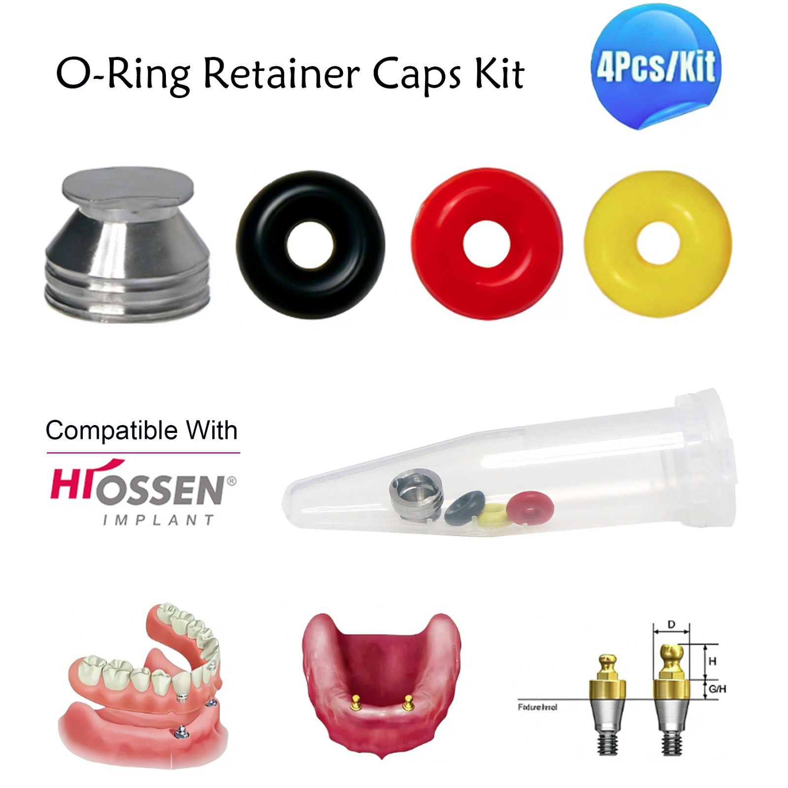 US Dental O-ring 4Pcs/Set for Ball Attachment Abutment Compatible Hiossen Osstem