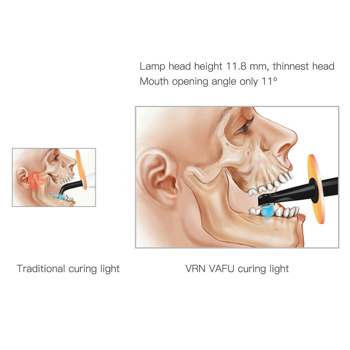 Dental LED Curing Light 1 Second Metal Body with Caries Detector Built Meter US