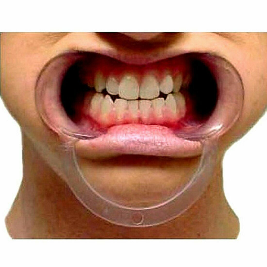 20Pcs C-Shape Mouth Opener Dental Teeth Whitening Lip Cheek Retractor Fun Game