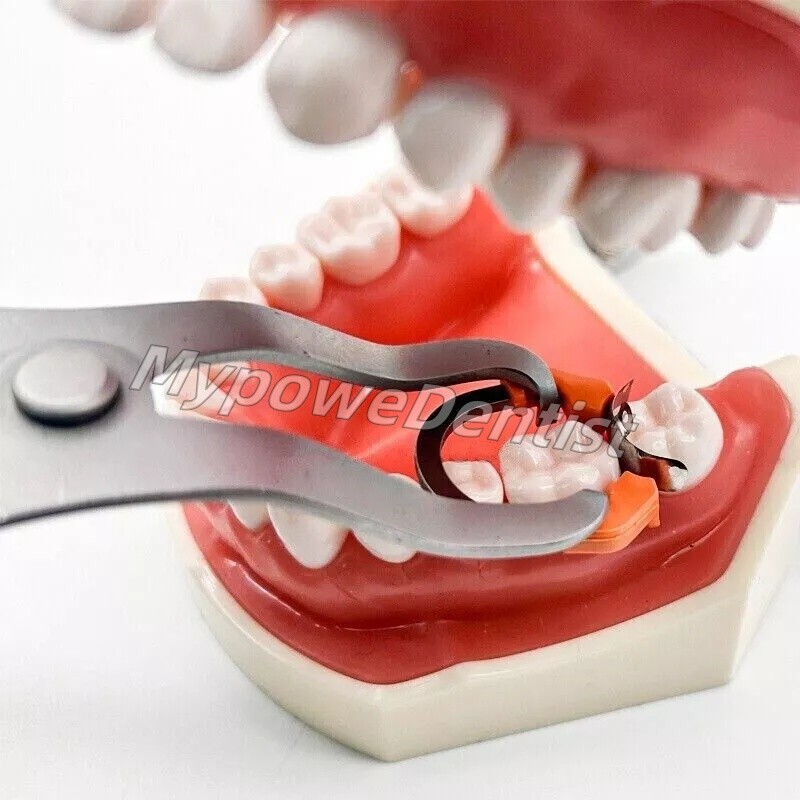 Dental Matrix Band Ring Sectional Matrice System D3 Clamp Fit Garrison Palodent
