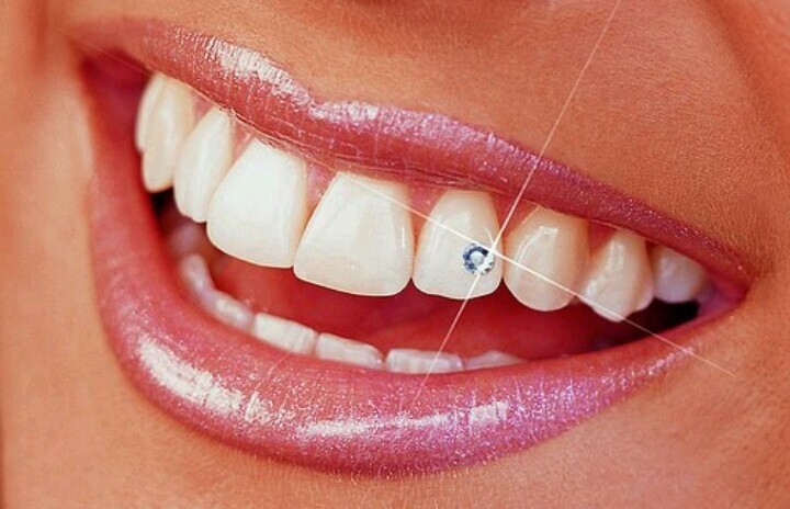 SparkleBites Professional Tooth Gem Kit. Strong tooth gem glue and tooth bonding